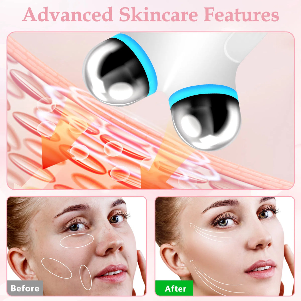 Microcurrent Anti-Wrinkle Facial Device - view 2