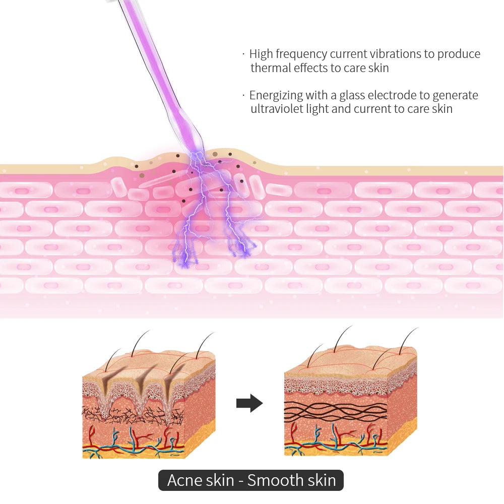 4-in-1 High-Frequency Facial Wand - view 3