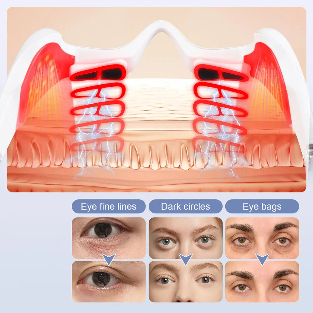 Eye Lifting and Firming Massage Device - view 3