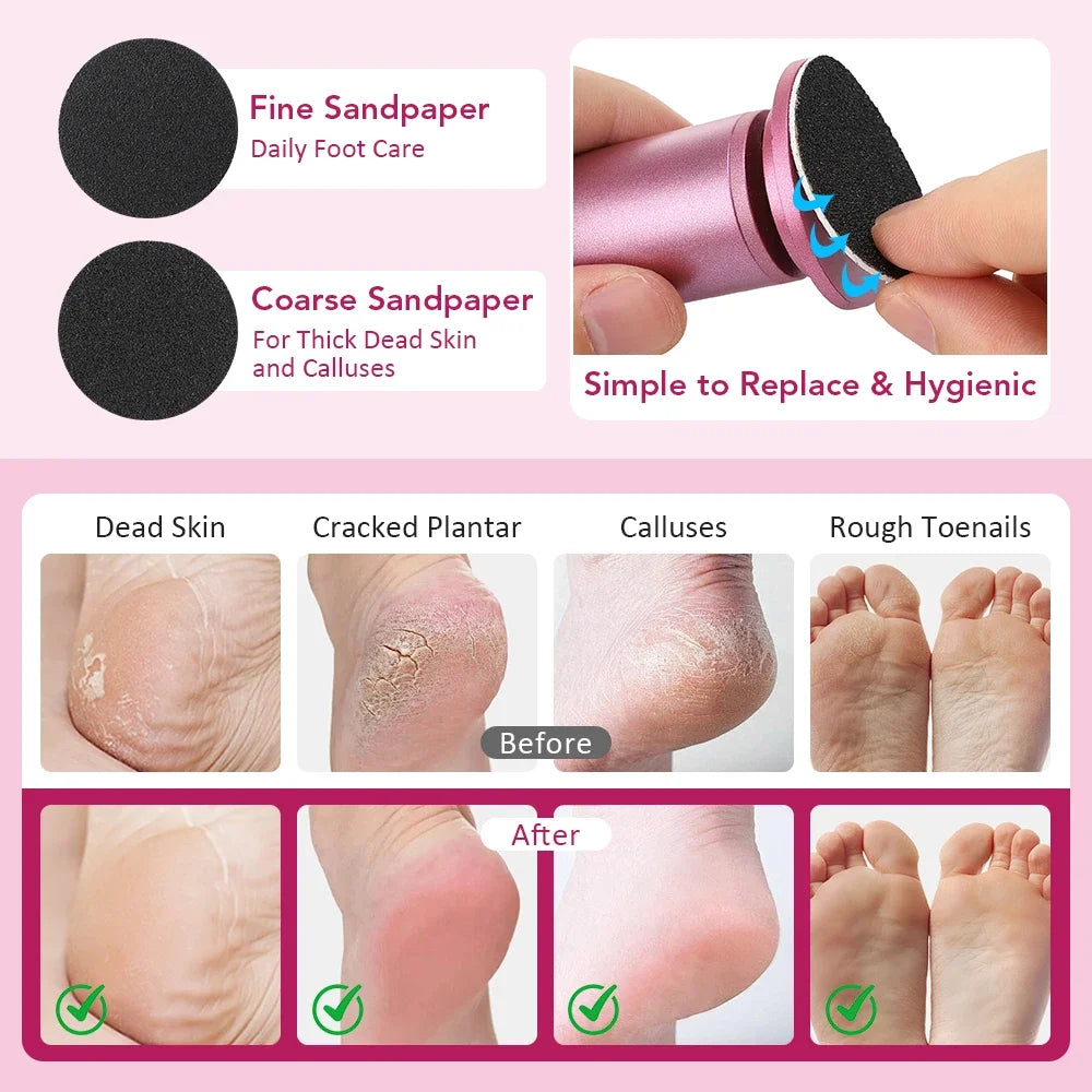 Electric Foot Callus Remover Set - view 4